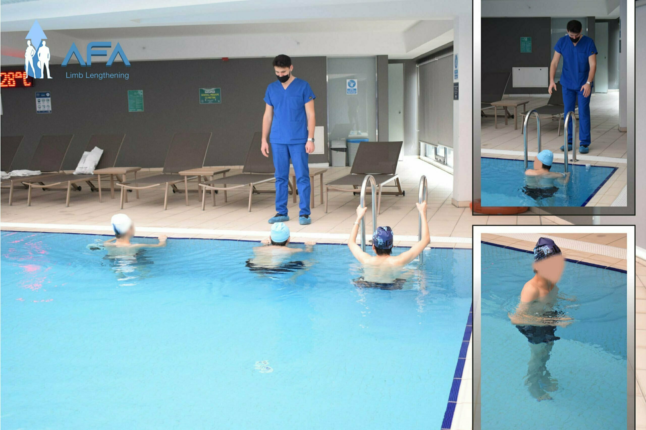 hydrotherapy exercises after limb lengthening surgery