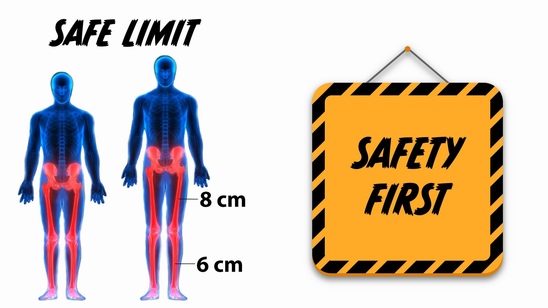 limb lengthening safety limits
